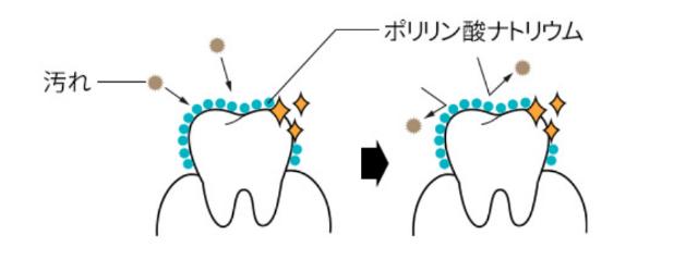 虫歯の発生を防ぐブレッシュホワイトニング